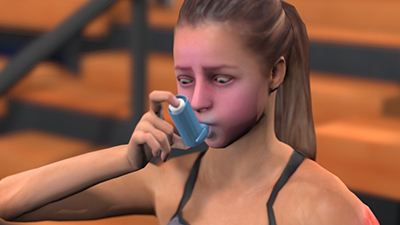 Anaphylaxis and Managing Allergies in Schools thumbnail image